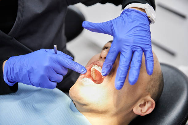Best Emergency Dental Services for Seniors in North Hornell, NY