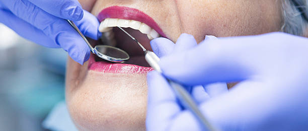 Best Emergency Dentist for Lost Fillings or Crowns in North Hornell, NY